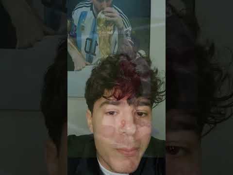 صاحب اطول زحلقة بتاريخ كرة القدم !!! صدم الجميع