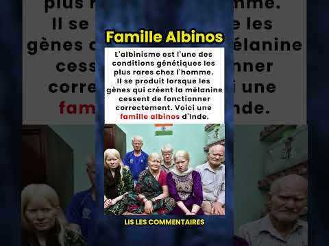 Albinisme : l'une des conditions génétiques les plus rares chez l'homme ! 🧬