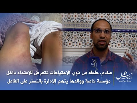 صادم..طفلة من ذوي الاحتياجات تتعرض للاعتداء داخل مؤسسة خاصة ووالدها يتهم الإدارة بالتستر على الفاعل