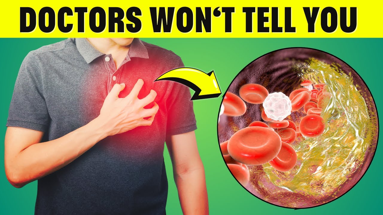 12 Best Foods that Dissolve Blood Clots | Prevent Stroke & Thin Blood Naturally