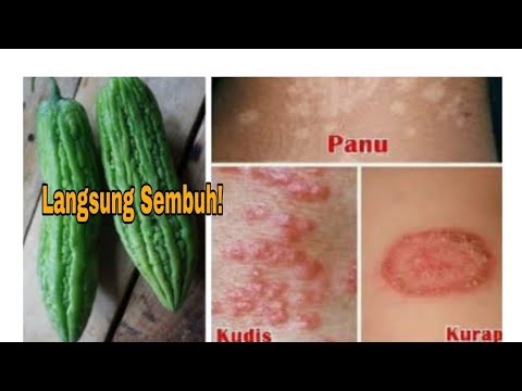 CARA MENGHILANGKAN GATAL-GATAL &PENYAKIT KULIT DG CEPAT