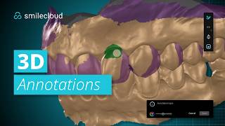 3D Annotations