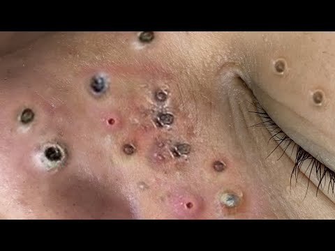 كيفية الحفاظ على نظافة الوجه يومياBT666
