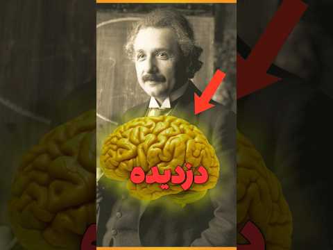 دزدیدن مغز انیشتین!!! | فکت های جالب و دانستنی ها