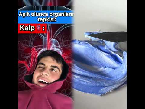 #pov #foryou #funny #acting #story #foryoupage#viral #skit #fyp シ #duet #tools  #fypviral