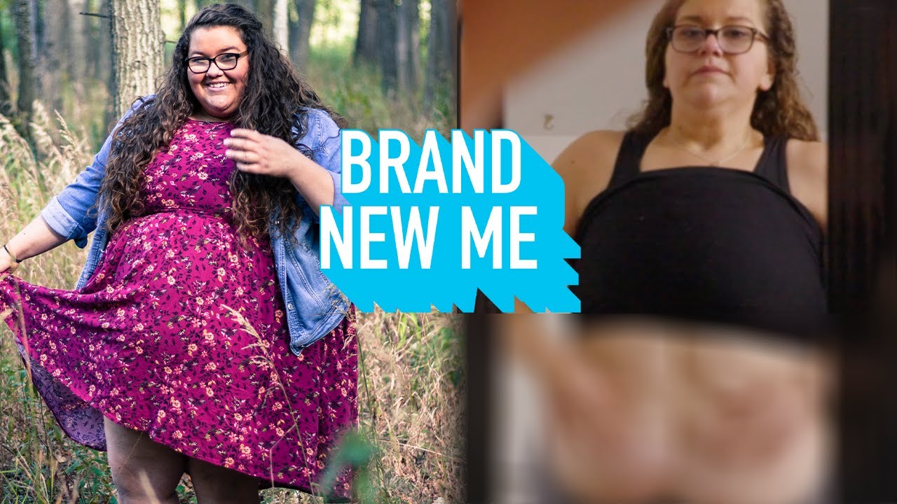 I've never revealed my excess skin - until now - brand new me