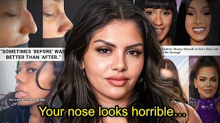 YOUR NOSE JOB DESTROYED YOUR FACE...