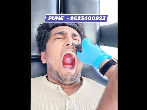 CFR for Facial Pain #chiropractor #cor #reelsvideo #reelsviral #migraine #viralshorts