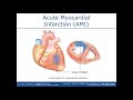 Heart Function and Myocardial Infarction