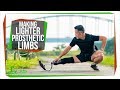 Understanding Prosthetic Limbs and Osseointegration
