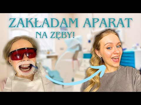 ZAKŁADAM APARAT ORTODONTYCZNY!