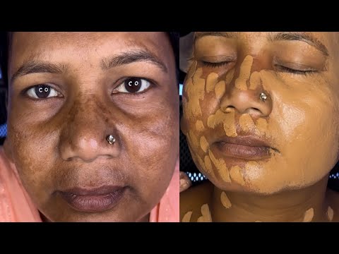 How To Cover Dark Circles/ Brown Skin/Pigmentation Skin | Step By Step Full Makeover