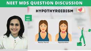 Hypothyroidism | NEET MDS Q/A & High-Yield Concepts