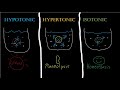 Isotonic, Hypotonic, and Hypertonic Solutions