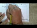 Combining Like Terms and Expressions