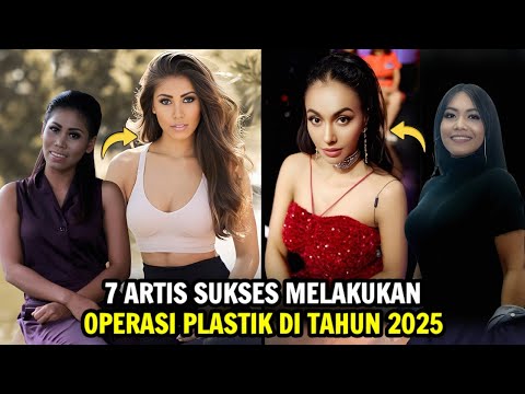 Seperti Beda Orang! 7 Artis Sukses Melakukan Operasi Plastik di Tahun 2025
