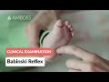 Understanding the Babinski Reflex