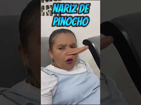 Se le creció la nariz por esto #drama #viral #shortsyoutube #shortsviral #familia