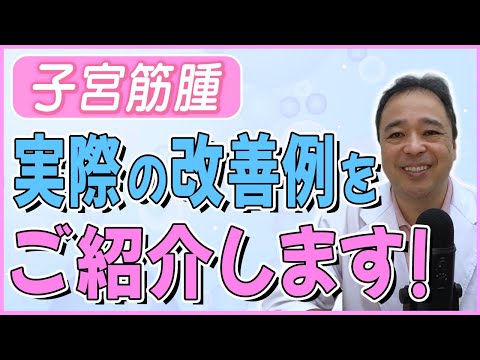 【子宮筋腫】聞けば役立つかも!?実際の症例のお話【専門家】
