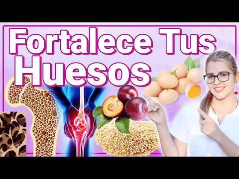 Alimentos Para Tus Huesos - Lo Mejores Alimentos Y Vitaminas Para Fortalecer  Los Huesos