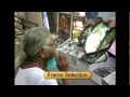 Aravind Eye Care Innovations and Impact