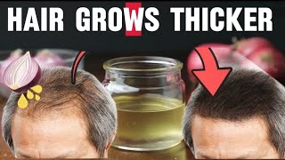 Grow thicker hair with this fermented onion home recipe.