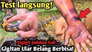 KORBAN GIGITAN ULAR BELANG BERBISA KEMBALI TERJADI! PENTINGNYA EDUKASI ULAR!!