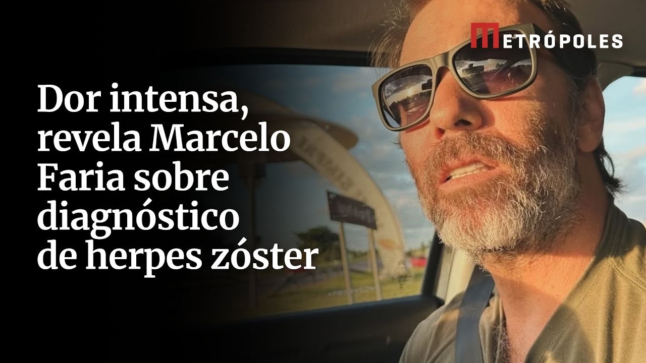 Dor intensa, revela Marcelo Faria sobre diagnóstico de herpes zóster