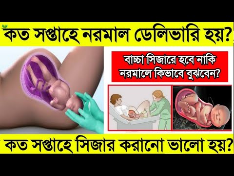 নরমাল প্রসবের ব্যথা কত সপ্তাহে উঠে? || কত সপ্তাহে সিজার করানো ভালো | নরমাল ডেলিভারির জন্য প্রস্তুতি!