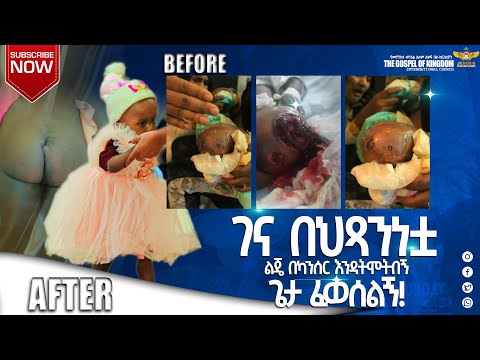 🙏የልጄን ጉድ ተመልከቱ ኢየሱስ OUR GOD Jesus Christ IS THE SOURCE OF HEALING—Testimony from Cancer patient kid