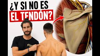 ¿Tu paciente NO mejora del hombro? Puede que estés mirando el tendón equivocado