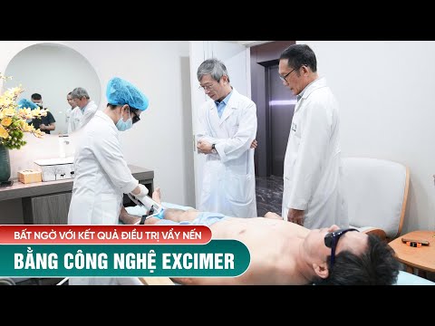 Hội đồng chuyên môn GHÉ THĂM BỆNH NHÂN VẨY NẾN & BẤT NGỜ với KẾT QUẢ ĐIỀU TRỊ của công nghệ EXCIMER