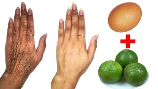 Esta Poderosa Mascarilla - Eliminar Las Manchas De La Edad Y Hacer Las Manos Suaves