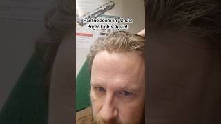 Lace Hairline After A Day Under More Bright Lights, Train Home, Graduated Hairline, Bleached Knots,