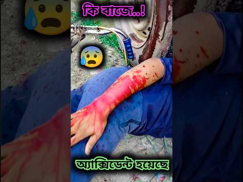 😵😔ছেলেটার কি বাজে অ্যাক্সিডেন্ট হয়েছে দেখো 😰😱 #shorts #viral #trending #comedy #like #funny #reels
