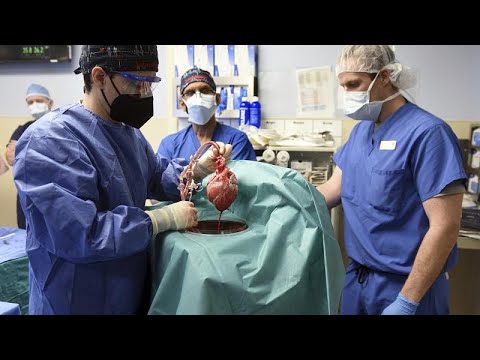 جراحون أميركيون ينجحون في زراعة قلب خنزير في إنسان