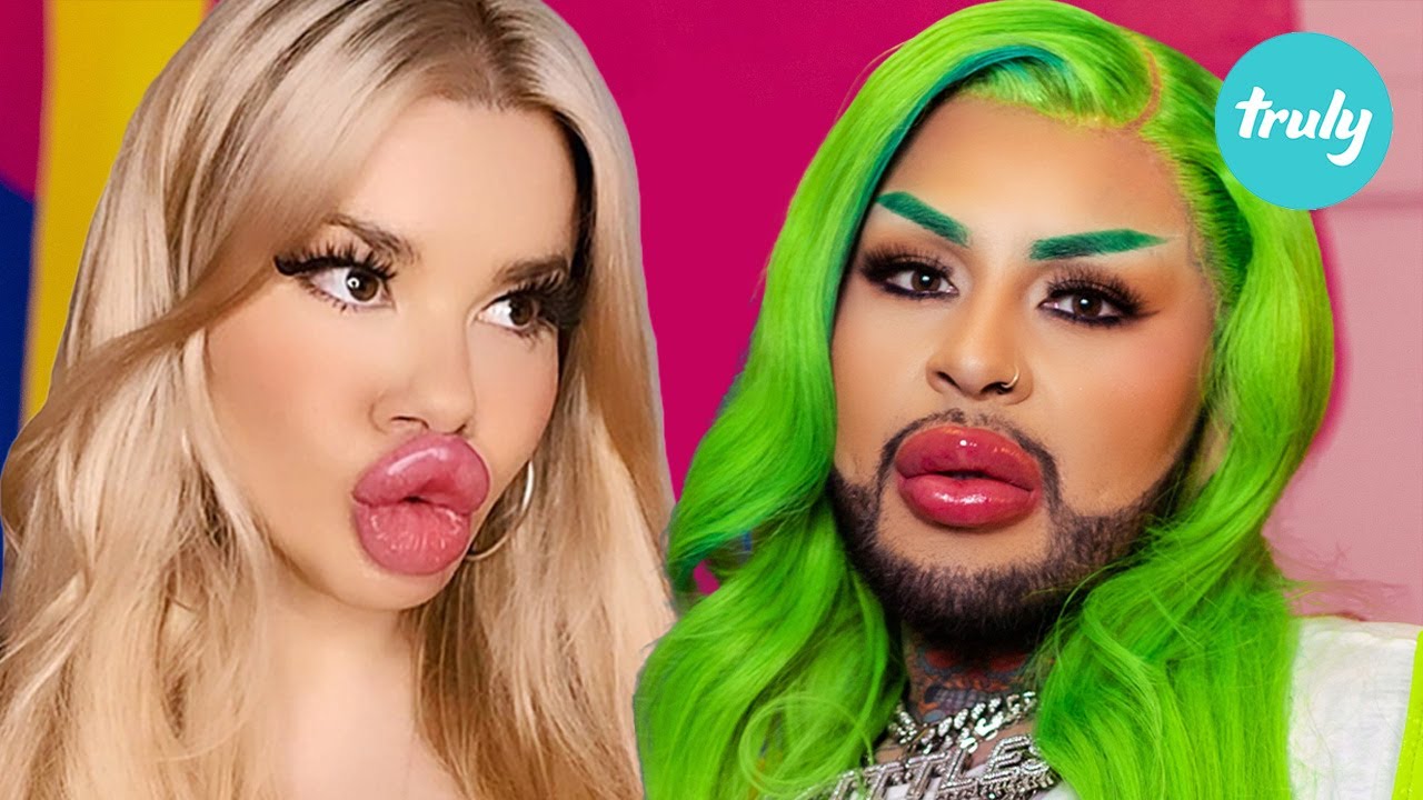 Are we addicted to fillers? - hooked on the look