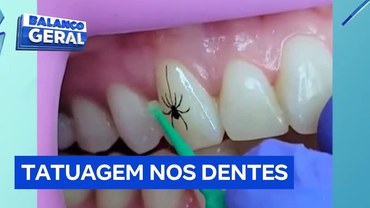 Tatuagem nos dentes é nova tendência no mundo e preocupa dentistas