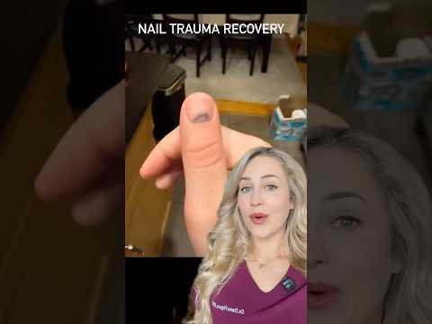 Doctor reacts: EXTREME nail injury