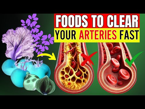 13 Powerful Foods That Clean Your Arteries and Protect Your Heart Naturally (Not TURMERIC)