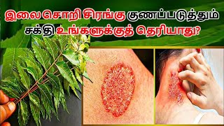 இலை சொறி சிரங்கு குணப்படுத்தும் சக்தி உங்களுக்குத் தெரியாது? | Best Home Medicine For Ringworm