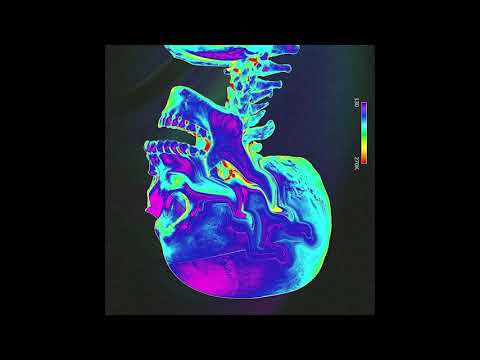 WORTH ~ Drake x Jack Harlow Type Beat (prod. Chakra)