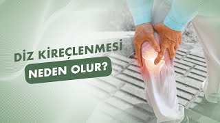 Diz Kireçlenmesi Tedavisi Nasıl Yapılır?
