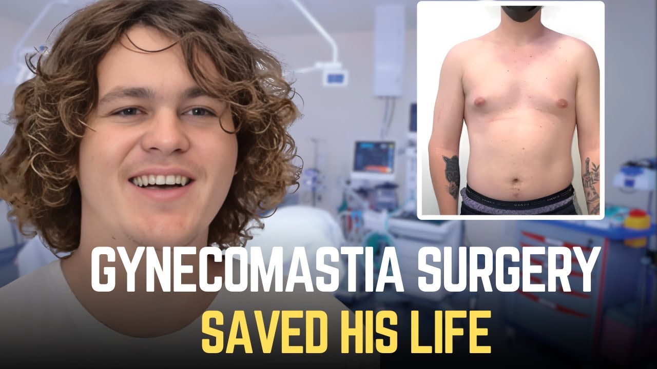 Gynecomastia surgery success story and transformation.