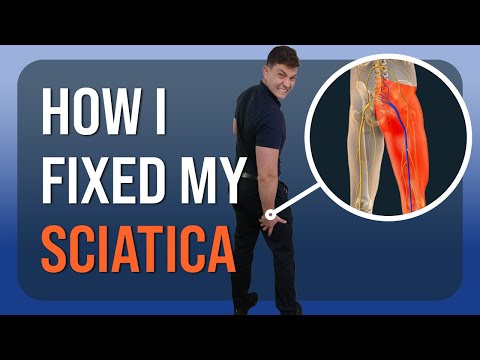 How I Healed My Sciatica: Personal Recovery Story