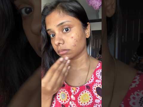 Pimples தொல்லை இனி இல்லை⁉️Over Night Remedy For பருஇல்லா முகம்❗#beautytips #shorts #makeup
