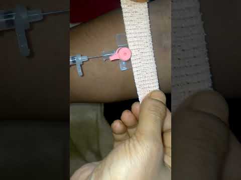 IV Cannulation Technique Porcedure