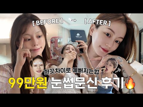 vlog | 99만원 눈썹 문신 5일 실시간 찐후기+일상 먹방 | 푸파 부부의 음주로그 | 브라질리언 레이저 | 홍대 찐맛집 라멘 | 닭백숙 삼겹살 소곱창 보쌈 | 집들이