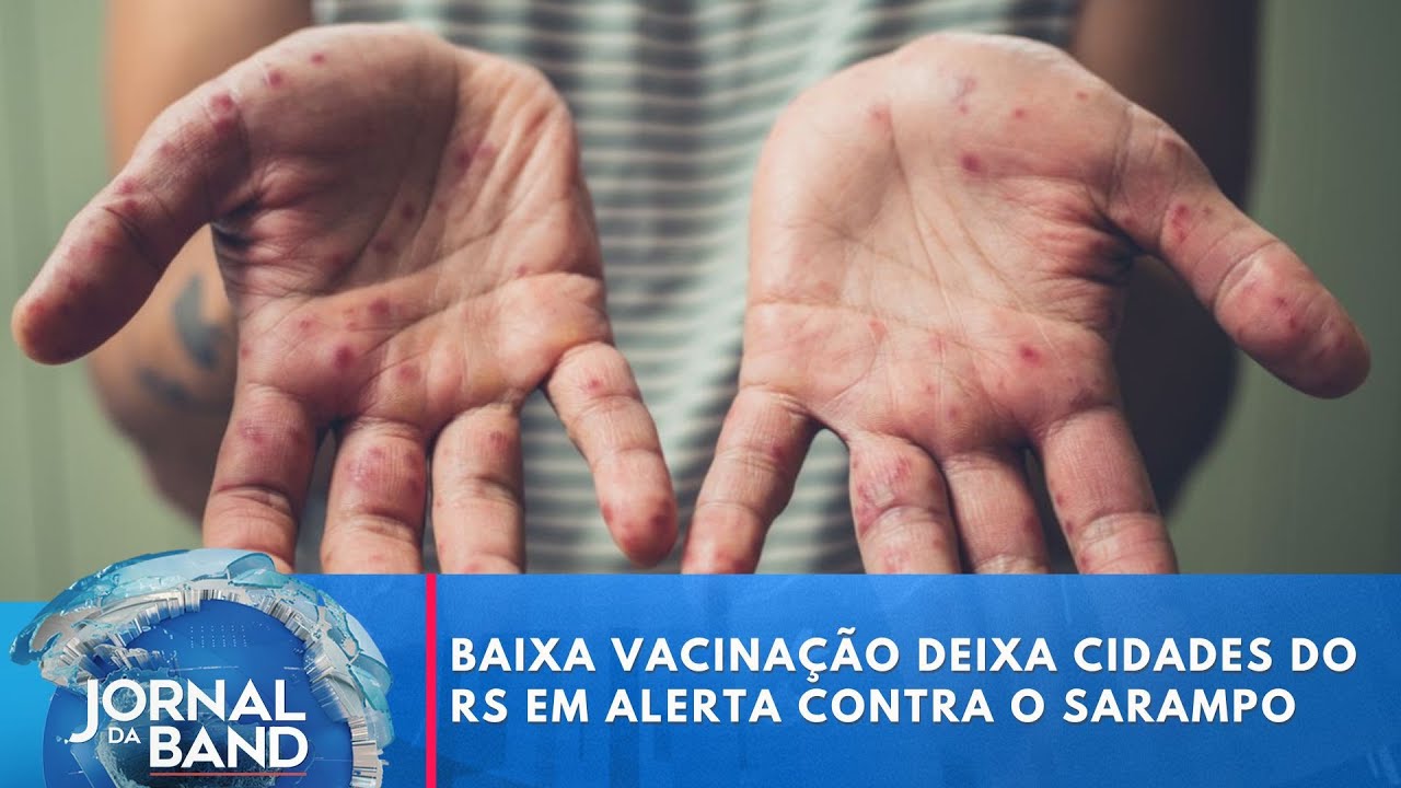 Baixa vacinação deixa cidades do RS em alerta contra o Sarampo | Jornal da Band