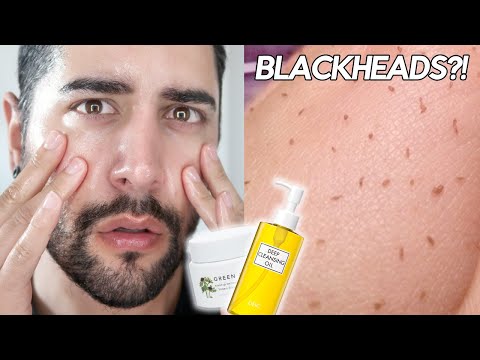Testing An Esthetician Approved Oil Cleansing Routine - OIL PLUGS?! BLACKHEADS?! ✖  James Welsh